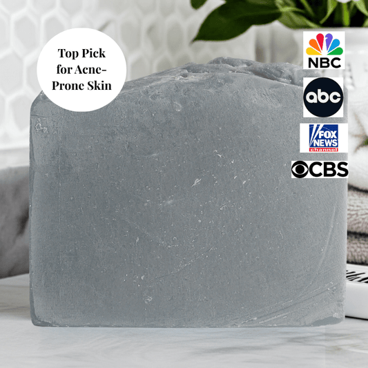 JOSSPURE Shea Butter Soap Bar for Oily Skin featuring gentle natural ingredients